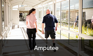Amputee
